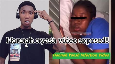 hannah yansh|Hannah Yansh’s Infection Video Goes Viral on TikTok